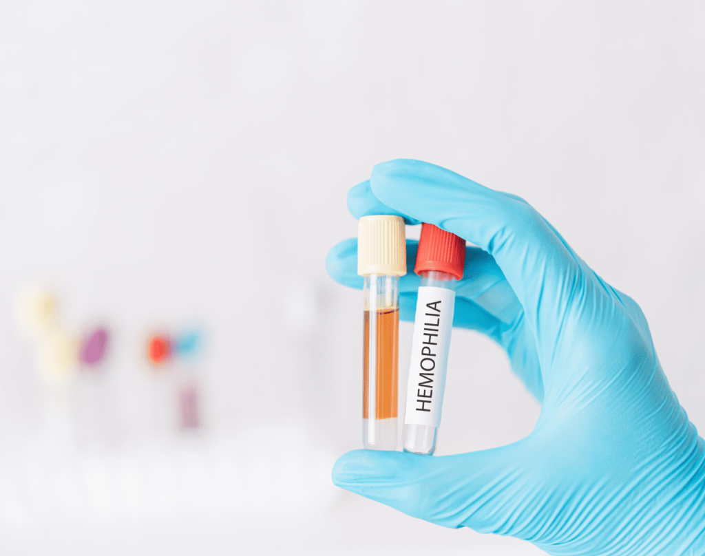 Pfizer's Gene Therapy